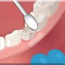 Operate Now: Dental Implant