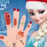 Elsas hand treatment