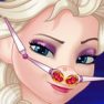 Elsa Nose Problems